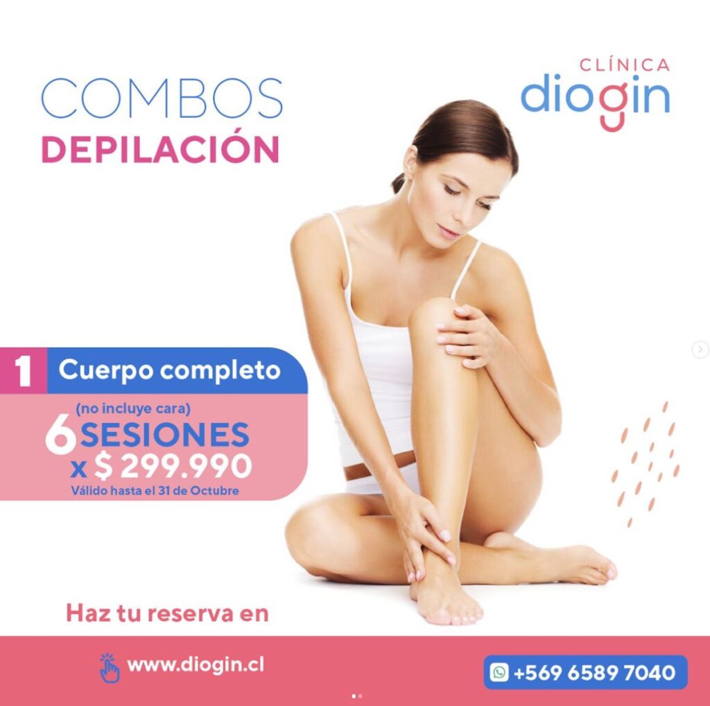 depilacion-laser-soprano-05